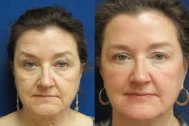Shubie doo's salon & day spa is a family full services salon & spa located at 302 buffalo road. Advanced Skin Care Spa Salon Lewisburg Pa