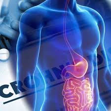 The immune system has evolved to protect the host from microbial infection; Il Morbo Di Crohn Una Malattia Autoimmune Molto Diffusa Il Centro Tirreno Nutrizione