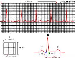 How To Read An Ekg Strip