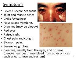 Symptoms of marburg virus disease are similar to those of other viral haemorrhagic fevers, such as ebola, and of infectious diseases like malaria or typhoid. What Is Marburg Disease And Its Treatment Your Health