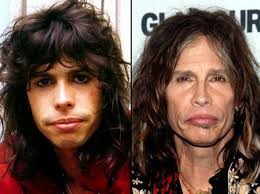 Unfortunately, accidents, age or genes can lead to a loss of full or partial vision, leaving us with a foggy or blurred vie. Is It Good Or Bad For Steven Tyler To Overuse Plastic Surgery Paperblog