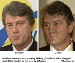 NSSS: Dioxin in Viet Nam 40 Years After the American War