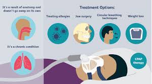 Image result for Sleep Apnea