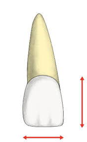 The mesiodistal dimension of a molar may be reduced by interproximal wear. Mandibular And Maxillary Central And Lateral Incisors Flashcards Quizlet
