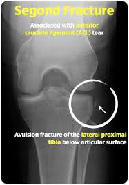 Rosh Review Medical Knowledge Radiology Imaging Radiology Student