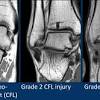 Related posts of foot muscle anatomy mri. Https Encrypted Tbn0 Gstatic Com Images Q Tbn And9gcqdye Sclrcs 7ju5exkbz9flm5sxoh2ak6tso1aeztzp4ddjjo Usqp Cau