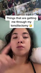 Day 2 #tonsillectomy