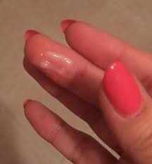 This egg is viable for pregnancy for next 24 hours. The Ultimate Guide To Cervical Mucus With Photos Fertility Awareness Project