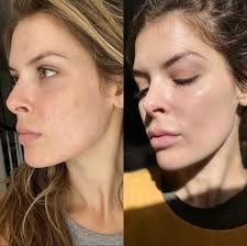 Skincare transformation and confidence boost with Bellame Beauty and Glow  Juice