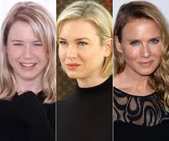 Podés comentar y pedir asesoramiento. Expertos En Cirugia Opinan Sobre El Cambio Radical De Renee Zellweger