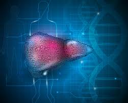 În ţările economic dezvoltate, ciroza hepatică este una dintre cele şase cauze primare de deces. Ciroza Hepatica Analize Medicale Recomandate Bioclinica