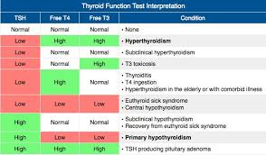 Rosh Review Thyroid Function Thyroid Function Tests Medical Mnemonics