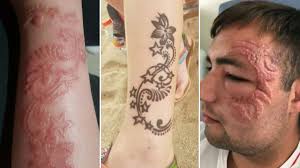 Suman has more than 15 years of experience as henna tattoo artist, accoladed for unique henna tattooing skills. Dangerous Black Henna Tattoos Leaving Bali Tourists With Permanent Scars