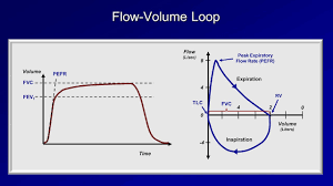 Pulmonary Function Tests Pft Lesson 2 Spirometry Youtube