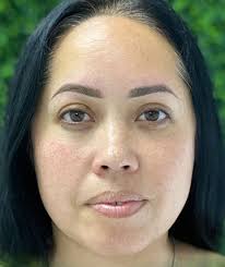 Permanent Makeup in Boca Raton, FL