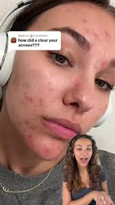 Emma Rose New Game Skin