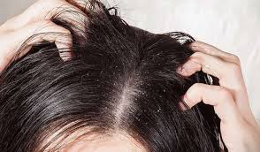 Long hair can mean commitment or working at something for a long period of time. What Does It Mean When You Dream About Lice 2021
