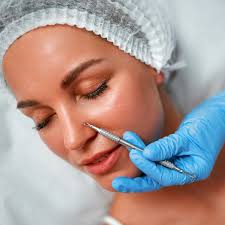 Manuelle Gesichtsausreinigung in Berlin bei Expert