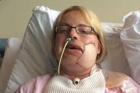 What does mouth cancer look like? Record View Jennifer S Tragic Case Shows The True Cost Of Nhs Failings Record View Daily Record