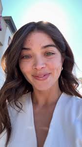 Reminder: ACNE IS NORMAL!!!! You are beautiful♥️ @Glò Aesthetic Spa  #acnejourney #acnetreatment #acneproneskin #acneskincare