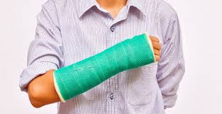 Der Bruch Am Ende Des Radius Gesunder Korper