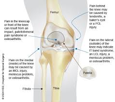 Image result for Knee Bulge Sign
