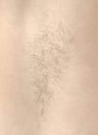 There are many variables that effect how quickly and effectively tattoo. Laser Hair Removal Seattle Dr Javad Sajan