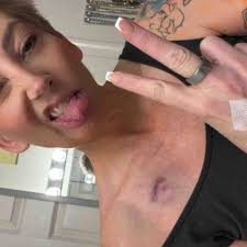 Fundraiser by Elizabeth Wiggington : Join Beth in her fight against HERS2  Breast Cancer