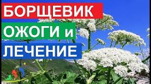 Как распознать, что перед вами именно ядовитое растение и чем оно так опасно? Borshevik Sosnovskogo Ozhogi I Lechenie Pervaya Pomosh Esli Vy Kosnulis Eto Yadovitoe Rastenie Youtube