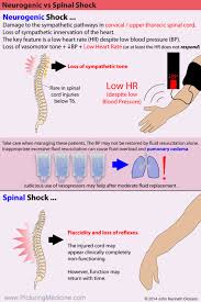 Image result for Spinal Shock