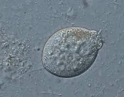 Image result for Protozoa