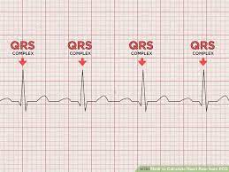 We did not find results for: How To Calculate Heart Rate From Ecg 8 Steps With Pictures Heart Rate Ecg Interpretation Soft Heart