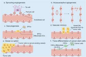 Image result for Angiogenesis