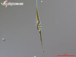 Ceratium é um género de protistas dinoflagelados 1 da ordem gonyaulacales 2, que apresenta dois flagelos heterocontos no sulco e no cíngulo. Ceratium Fusus Ehrenberg Dujardin 1841 Algaebase