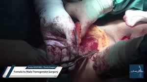 Maybe you would like to learn more about one of these? Serdar Nasir Md Plastic Surgery Female To Male Transgender Surgery Youtube