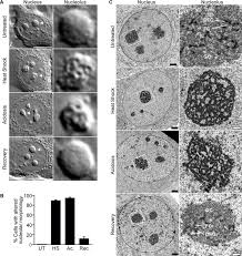 Nucleoli also participate in the formation of signal recognition particles and play a role in the cell's response to stress. The Nucleolus Responds Structurally To Environmental Stimuli A Dic Download Scientific Diagram