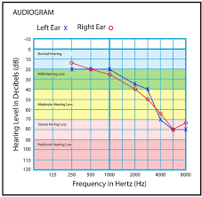 Image result for Audiogram