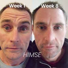 HIMSE Awaken Peptide Depuffing Eye Gel