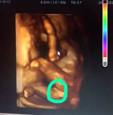 Hallo ihr lieben, ich war am dienstag beim fa bezüglich des arbeitsverbots. Baby S Geschlecht Wunsch Vermutung Outing 2 0 Oktober 2017 Babyclub Seite 17 Babycenter