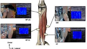 The following stretches will tell you exactly what muscle you are stretching. Probe Location On Each Hamstring Muscle Download Scientific Diagram