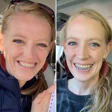 DALLAS CENTER FOR ORAL & MAXILLOFACIAL SURGERY