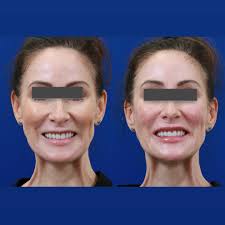 Northwest Aesthetics (@northwestaesthetics) • Facebook