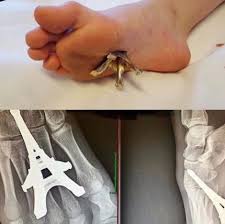 Рентген минет  funny cocks & best free porn: r34, futanari, shemale,  hentai, femdom and fandom porn