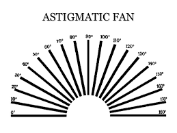 astigmatism by sumayya naseem