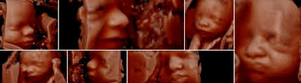 2769 coney island ave brooklyn, ny, 11235 united states. Tips Your Never Knew The Perfect Way To Get Ready For Your 3d Ultrasound 3d 4d Ultrasound Studio Queens