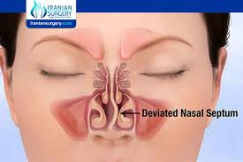 Is nasal endoscopy a major surgery or minor surgery? Zcf1kaaau7enmm