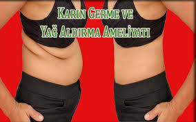 Karin Germe Ve Yag Aldirma Ameliyati Yag Saglik Gobek Deligi