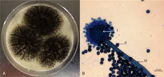 Aspergillus are found in millions in pillows. Occurrence Of Aspergillus Niger Strains On A Polychrome Cotton Painting And Their Elimination By Anoxic Treatment