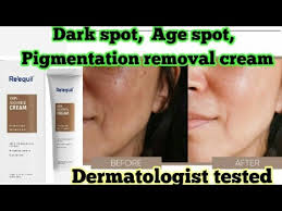 I had dark spots over my face & pigmentation around my lips. Re Equil Skin Radiance Cream Dark Spot Age Spot Pigmentation Brijwasi Girl Youtube