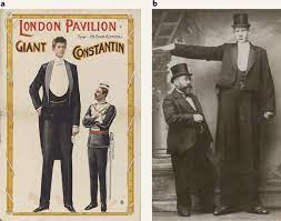 Tall stature may result from hereditary, dietary, or other factors. The Causes And Consequences Of Pituitary Gigantism Nature Reviews Endocrinology X Mol